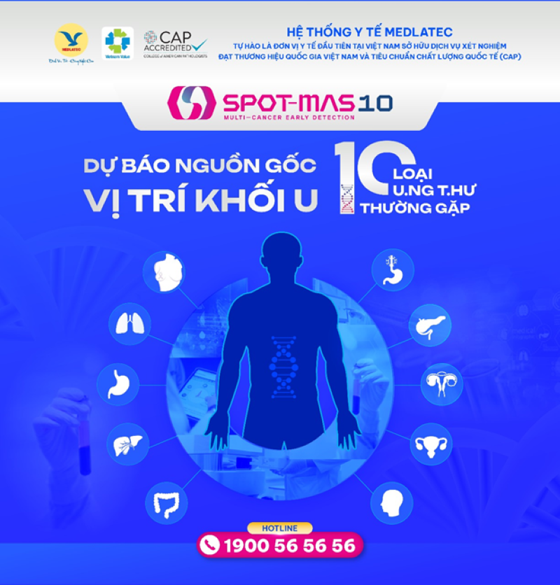 Xét nghiệm SPOT-MAS 10 giúp sàng lọc 10 loại ung thư phổ biến 