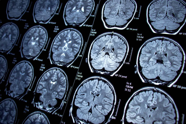 Tìm hiểu về cộng hưởng từ sọ não và ứng dụng trong y học