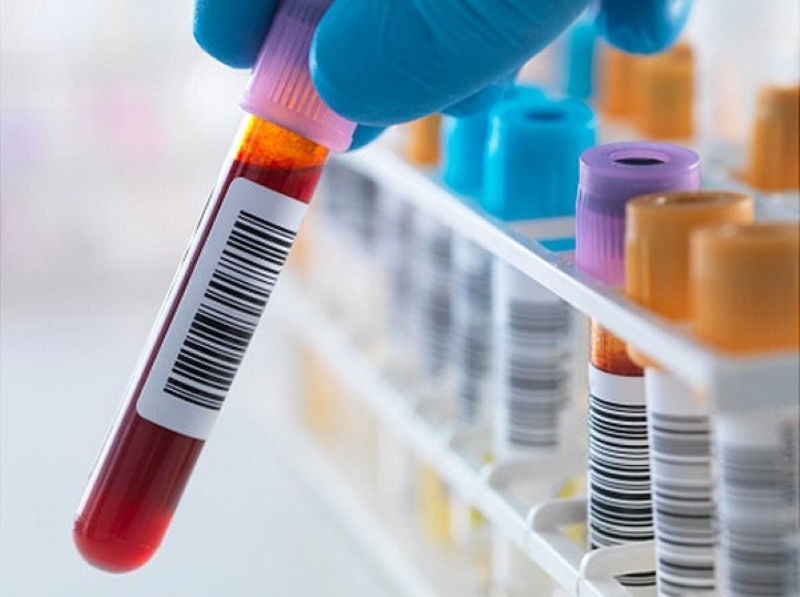 Độ chính xác của công nghệ phân tích ctDNA trong máu chỉ dấu ung thư sớm đã được kiểm chứng 