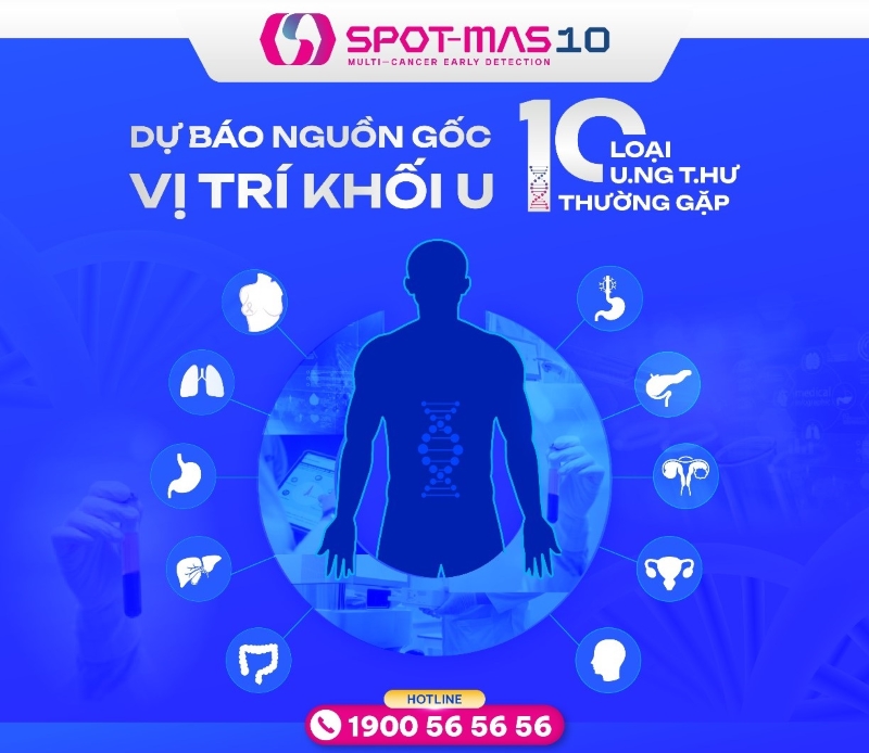 SPOT-MAS 10 là kỹ thuật hiện đại ứng dụng công nghệ phân tích ctDNA trong máu chỉ dấu ung thư sớm