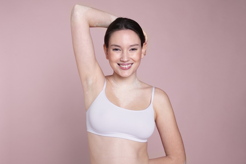 Những khối u bã đậu thường có thể di chuyển dưới da