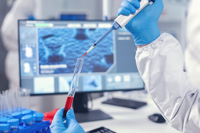 Xét nghiệm Toxocara IgG được thực hiện bằng kỹ thuật ELISA giúp chẩn đoán nhiễm giun đũa chó, mèo