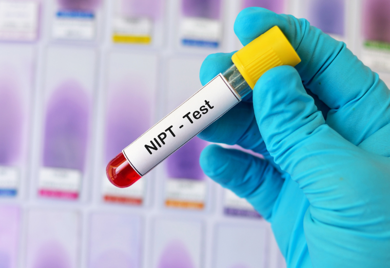 NIPT có thể thực hiện sớm, ngay từ tuần thai thứ 10