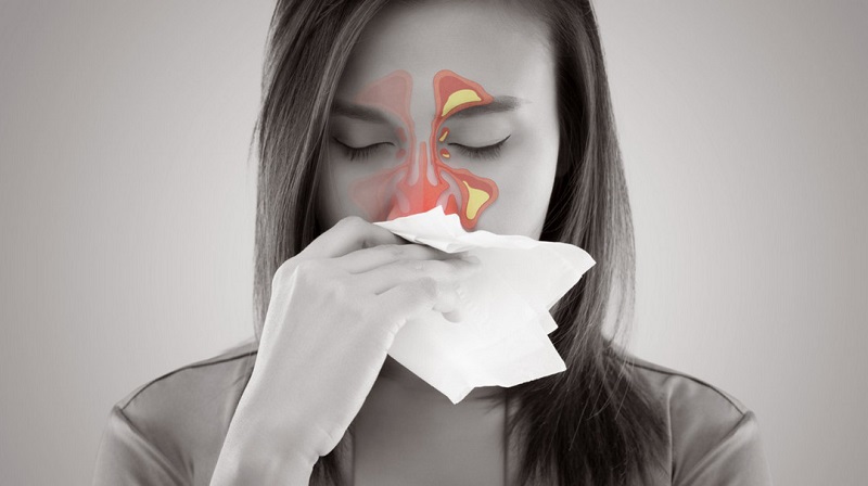 Polyp mũi có thể gây biến chứng như: viêm xoang cấp hoặc mạn tính, mất mùi, ngưng thở khi ngủ, biến dạng khuôn mặt... (ảnh minh họa) 