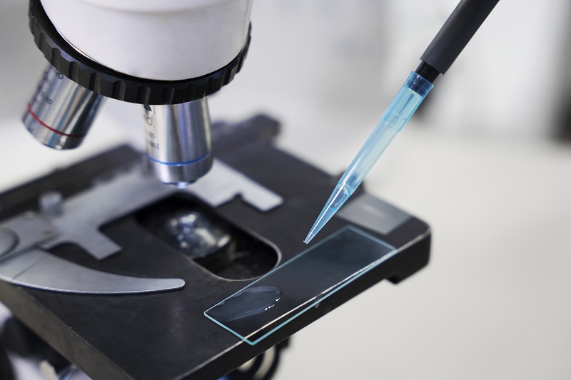 Xét nghiệm Thinprep được thực hiện với kỹ thuật lọc hiện đại, tăng tính chính xác trong sàng lọc ung thư cổ tử cung