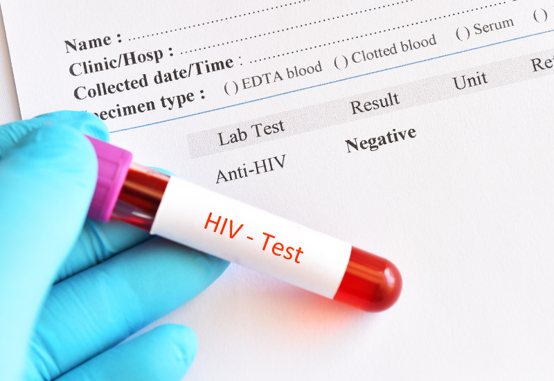 Kết quả xét nghiệm HIV âm tính có nghĩa là chưa phát hiện dấu hiệu kháng thể hoặc kháng nguyên HIV tại thời điểm xét nghiệm
