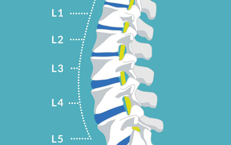 Xem x quang cột sống thắt lưng thẳng nghiêng và cách điều trị hiệu quả