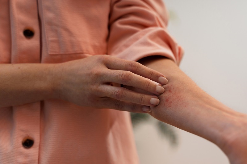Ngứa nhiều có thể là dấu hiệu nhiễm ấu trùng giun đũa