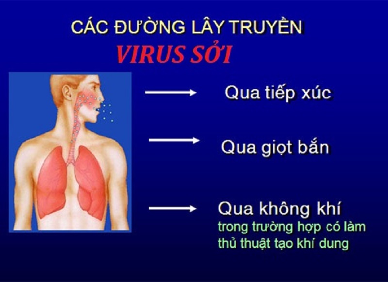 Sởi lây qua những con đường nào