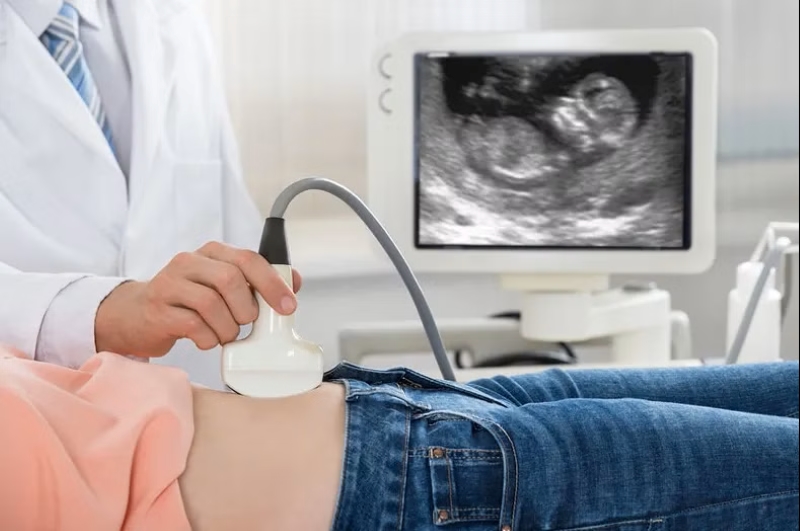 Siêu âm thai là phương pháp chẩn đoán chắc chắn nhất tình trạng mất tim thai 