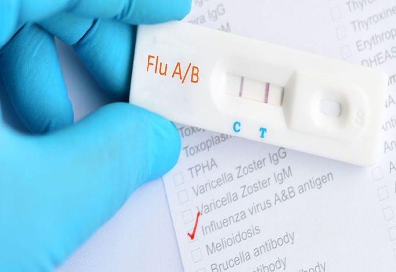 Bị cảm cúm test nhanh có lên 2 vạch không là thắc mắc của nhiều người bệnh