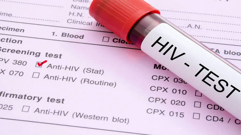 Cần chủ động thăm khám nếu phát hiện các dấu hiệu nghi ngờ mắc HIV 