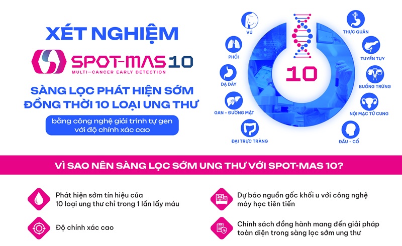 Xét nghiệm SPOT-MAS 10 giúp sàng lọc và phát hiện sớm 10 loại ung thư  