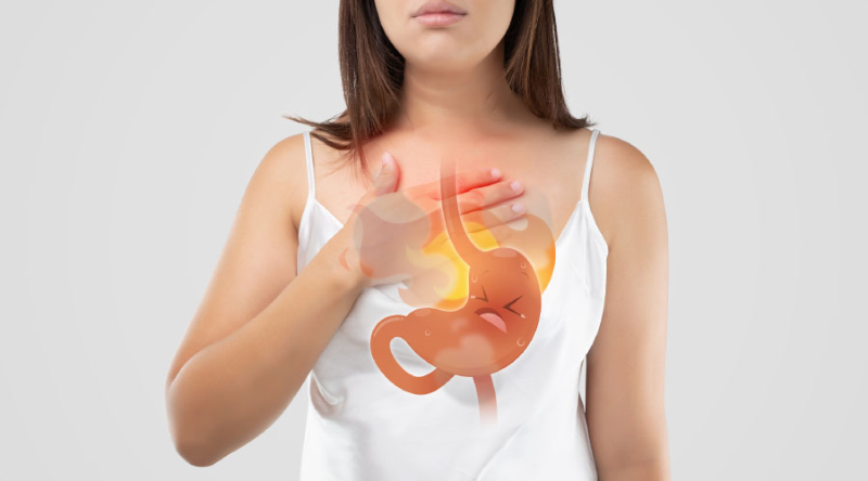 Ợ nóng, ợ chua là triệu chứng điển hình ở người bị trào ngược dạ dày