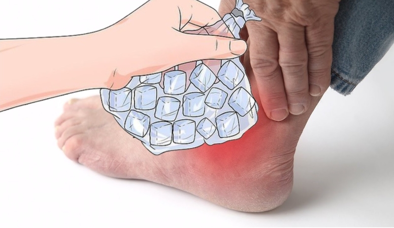 Chườm lạnh là một trong những cách giảm đau gout nhanh nhất 