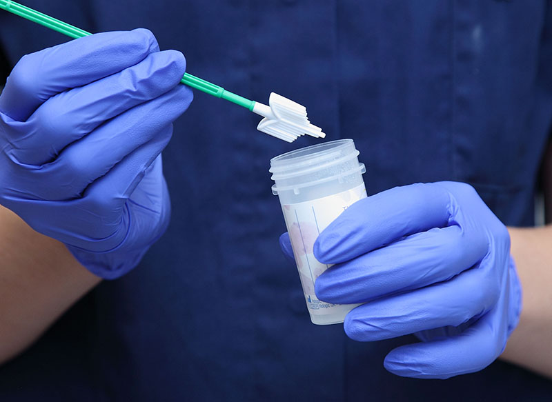 Xét nghiệm HPV là phương pháp phổ biến hiện nay được áp dụng với phụ nữ ở độ tuổi 30 trở lên 