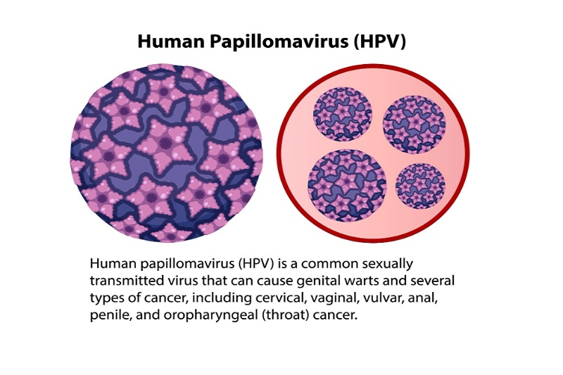HPV gây nên bệnh sùi mào gà