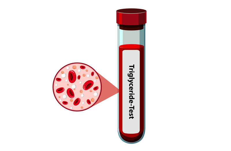 Chỉ số triglyceride phản ánh nồng độ chất béo trong máu