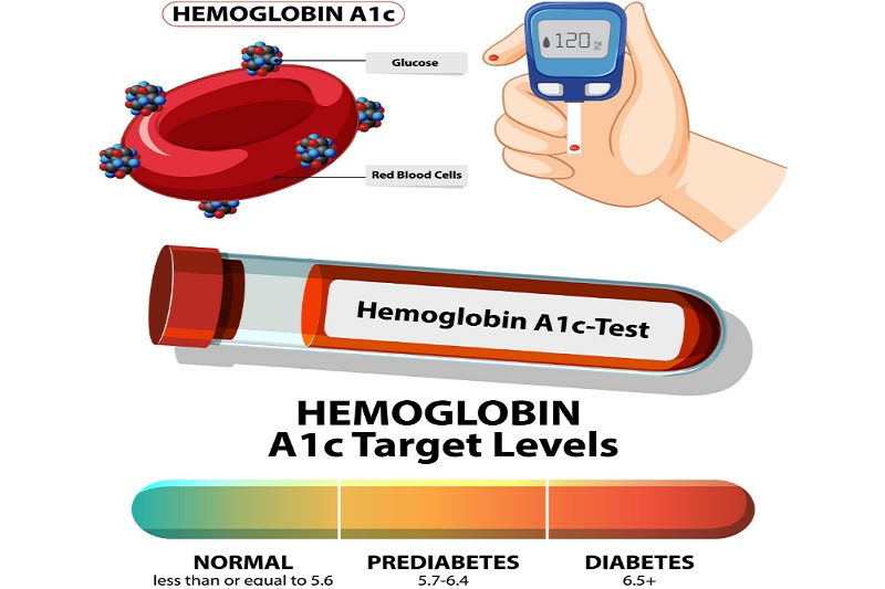 Xét nghiệm HbA1c kết hợp chỉ số đường huyết lúc đói là căn cứ chẩn đoán tiểu đường