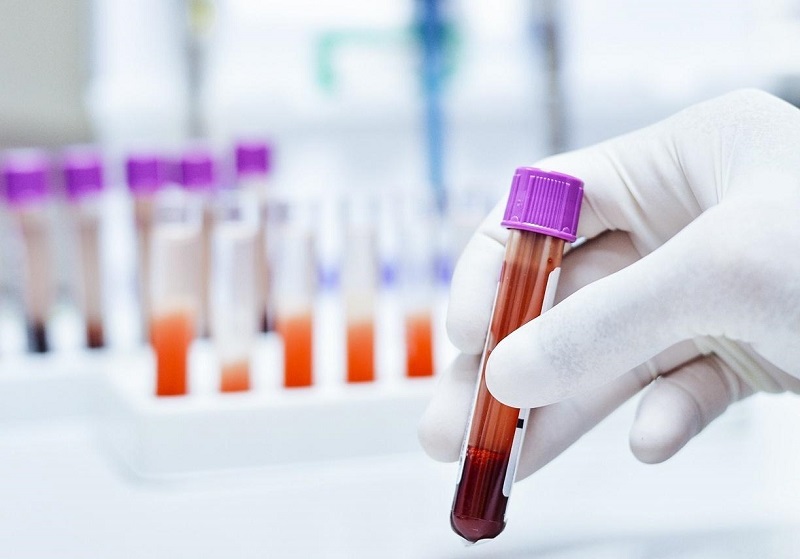 IgG tăng so với ngưỡng tham chiếu, gợi ý tình trạng nhiễm Toxocara