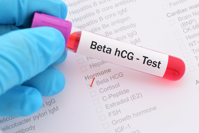 Xét nghiệm nồng độ hormone hCG có thể được chỉ định nhằm chẩn đoán chính xác tình trạng thai ngoài tử cung tự tiêu 