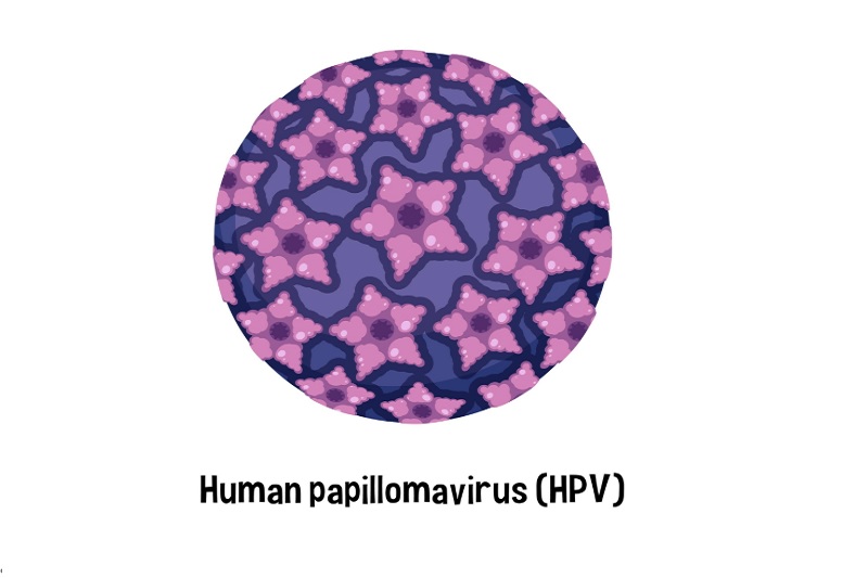 HPV virus thường gây nên u nhú