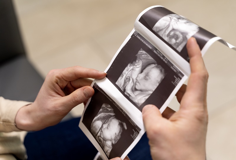 Axit folic trong đậu bắp giúp hỗ trợ phòng ngừa nguy cơ thai nhi bị dị tật ống thần kinh 