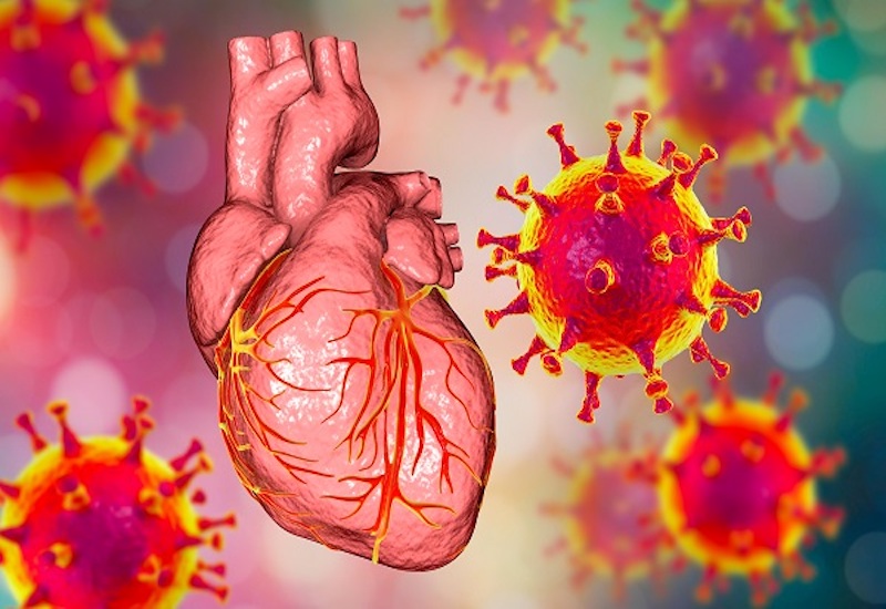 Tại sao trong bệnh Covid-19, tim mạch của người bị nhiễm virus SARS-CoV-2 có thể đập nhanh?
