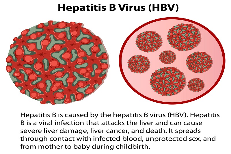 HBV virus gây bệnh viêm gan B