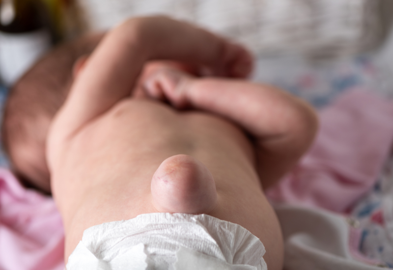 Thoát vị thành bụng tiềm ẩn nhiều biến chứng nếu chậm trễ điều trị