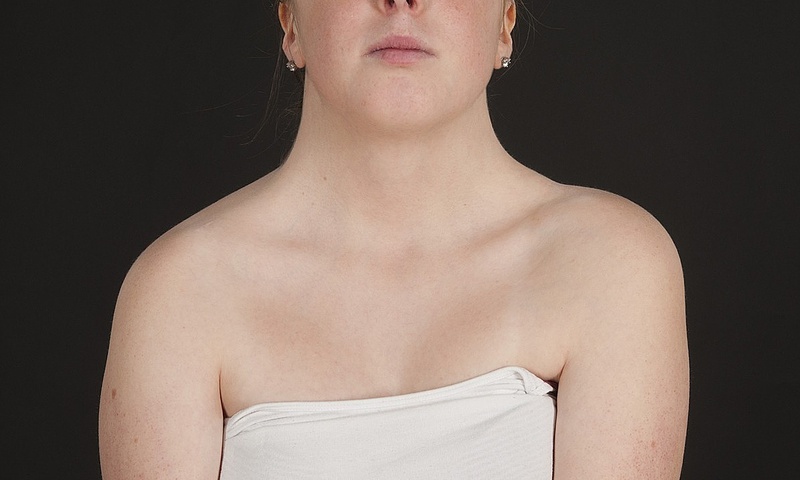 Mang thai ở bệnh nhân nữ mắc bệnh Turner là hiện tượng hiếm gặp (Ảnh minh họa - Nguồn: Inernet)  