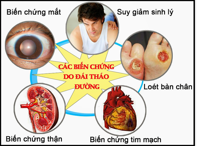 Đái tháo đường gây ra nhiều biến chứng nguy hiểm.