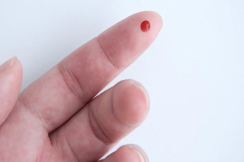 Hình ảnh mô phỏng phương pháp chích máu đầu ngón tay sơ cứu đột quỵ bằng kim