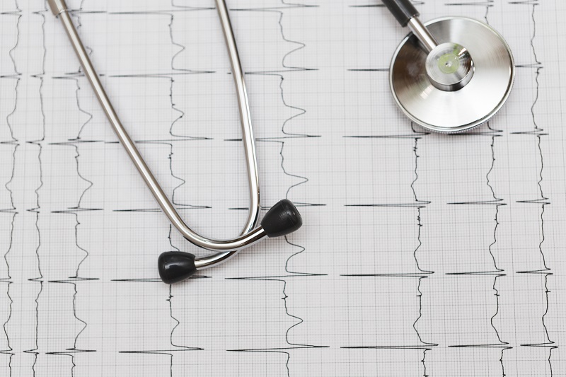 Dựa trên kết quả ECG bác sĩ sẽ nhận diện được bất thường hoạt động điện tim