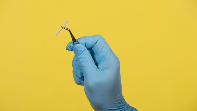 Có nhiều nguyên nhân khiến cấy que tránh thai vẫn có kinh nguyệt