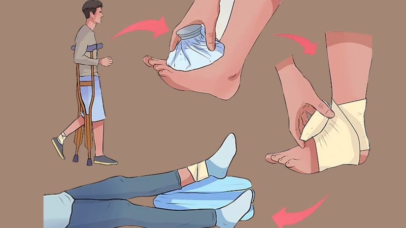 Nguyên tắc R.I.C.E được ứng dụng khi vừa bị trật mắt cá chân