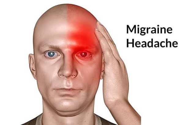 Đau nửa đầu ( hay đau đầu Migraine, đau đầu vận mạch)