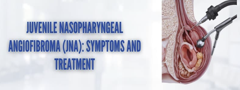 Phẫu thuật nội soi cắt bỏ khối u xơ vòm mũi họng