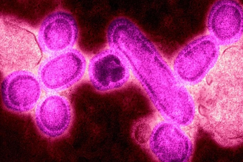 Đại dịch cúm Tây Ban Nha gây nên bởi virus cúm A