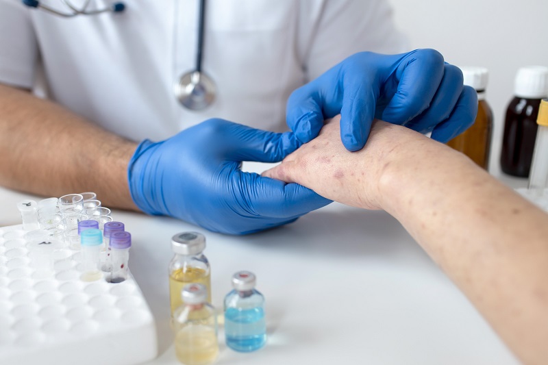 Nếu không nhận diện giang mai giai đoạn 2 sẽ chuyển sang giai đoạn tiềm ẩn, dễ biến chứng