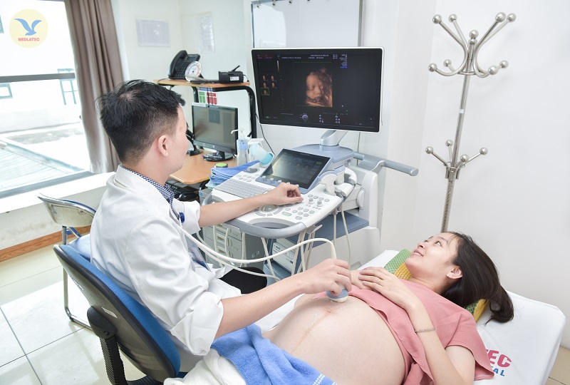 Bác sĩ MEDLATEC thực hiện siêu âm thai