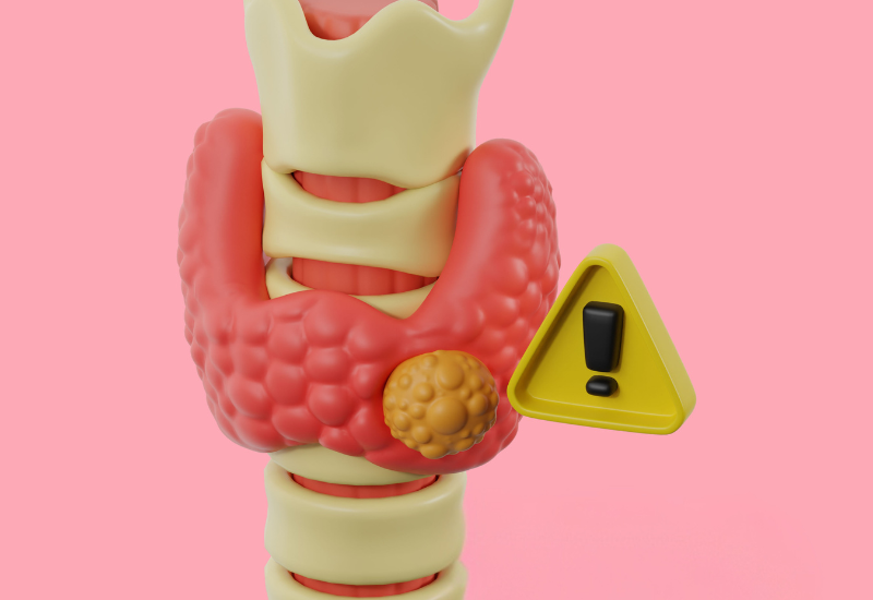 U tuyến giáp là tình trạng xuất hiện các khối u bất thường bên trong tuyến giáp