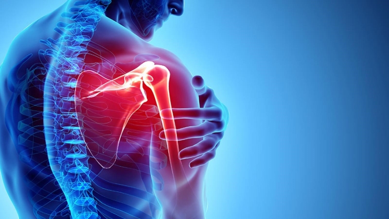 Tình trạng viêm hoặc thoái hóa khớp vai có thể gây ra tình trạng đau nhức bả vai và cánh tay phải