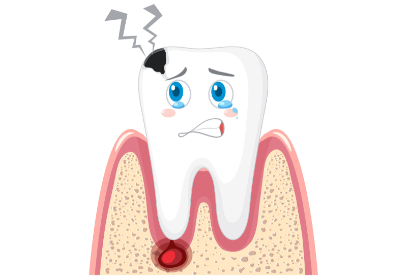 U nang răng có thể gặp ở cả hàm trên lẫn hàm dưới, với nhiều dạng khác nhau