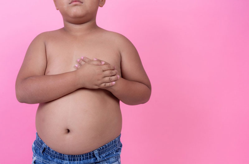 Trẻ em bị béo phì có nguy cơ mắc bệnh lý về tim mạch
