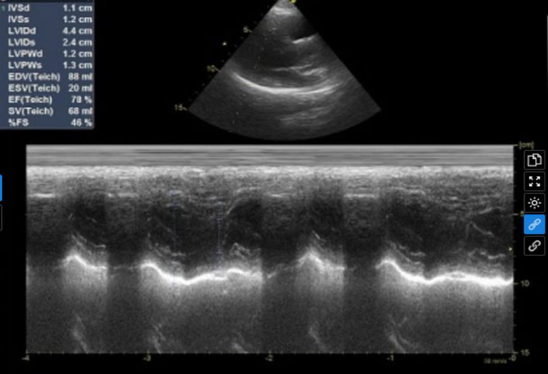 Kết quả siêu âm tim và màng phổi của bệnh nhân 