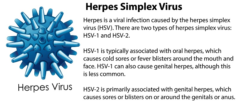 Virus HSV-1, HSV-2 gây nên mụn rộp sinh dục