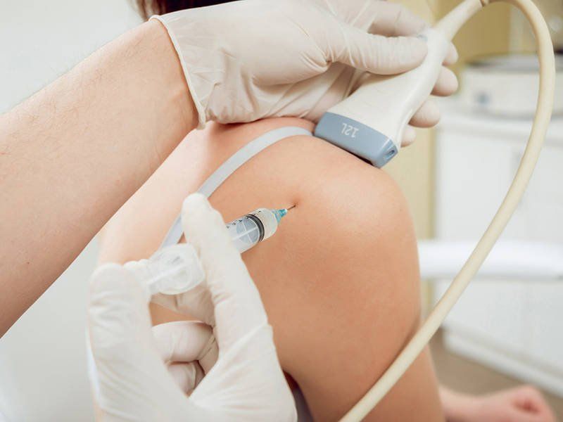 Tiêm nong khớp vai là kỹ thuật điều trị thể đông cứng an toàn và hiệu quả