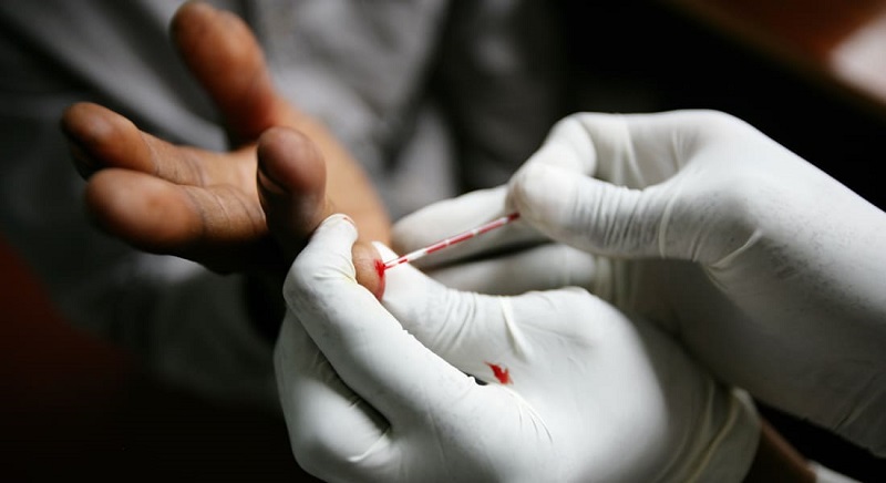 Người bệnh cần tuân thủ đúng thời điểm xét nghiệm