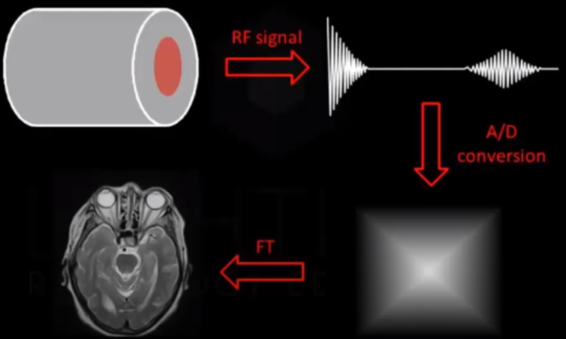 Nguyên lý vận hành của máy MRI được xây dựng trên hiện tượng cộng hưởng từ của các hạt nhân